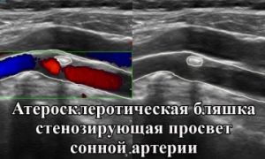 Дс бца что это такое