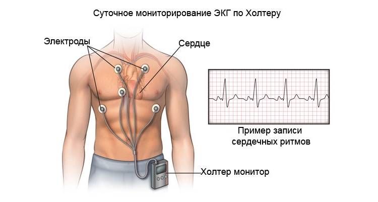 Схема применения портативного устройства