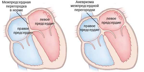 5468846486