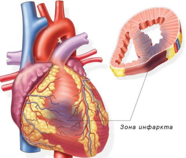 Многим данное понятие незнакомо, другие знают о нем практически все