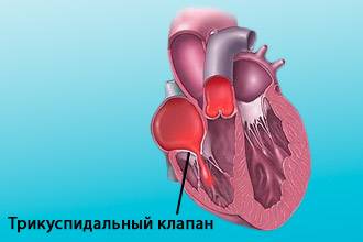 Трикуспидальный клапан Трикуспидальный трехстворчатый клапан