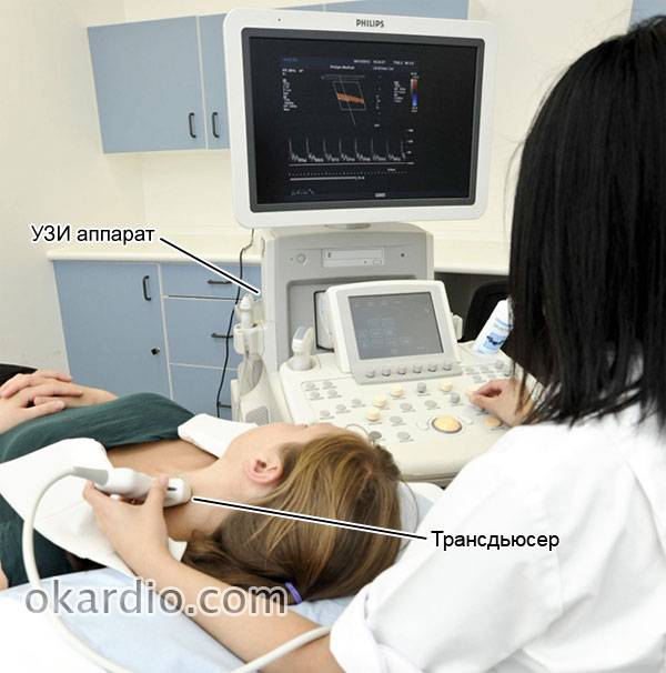 УЗИ сонной артерии