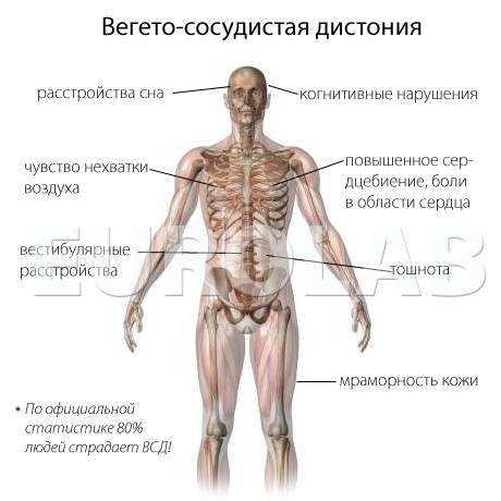 вегето-сосудистая дистония