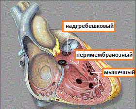 виды дмжп