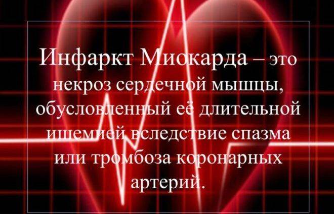 Инфаркт миокарда