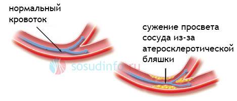 9859038593849583989