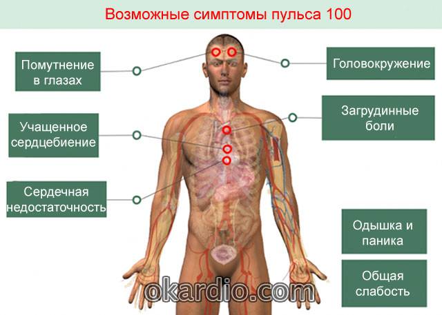 симптомы высокого пульса