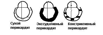 Классификация форм заболевания и их особенности