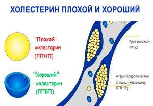 Виды холестерина