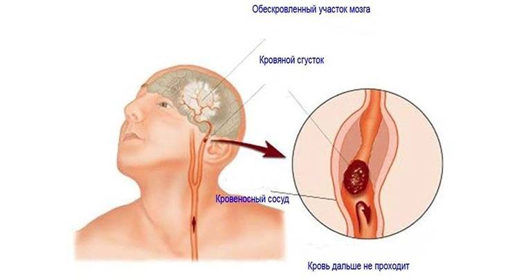 Классификация видов данного заболевания
