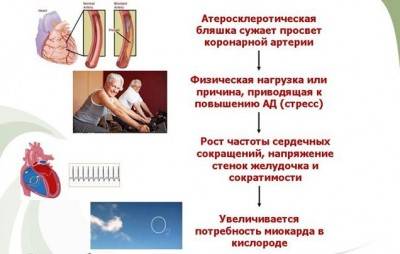Причины возникновения приступа