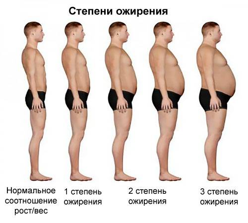 степени ожирения