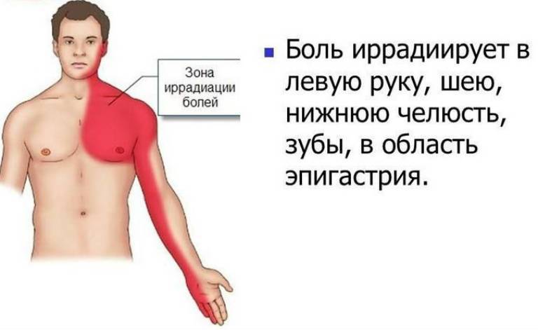Прогрессирующая стенокардия что это такое