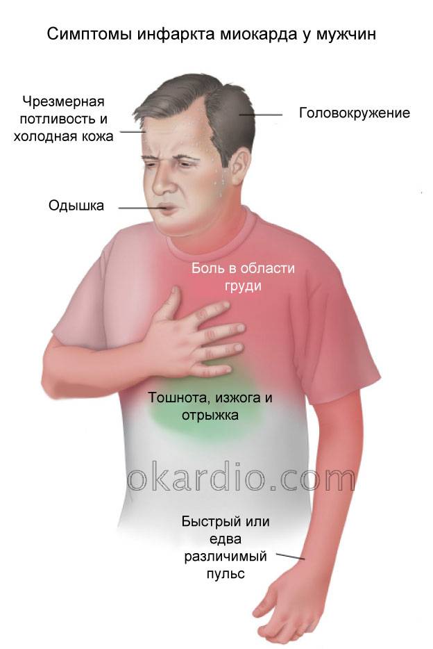 симптомы инфаркта у мужчин