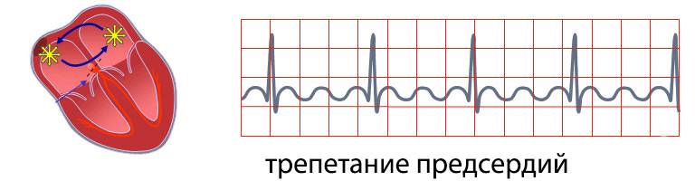 1355588