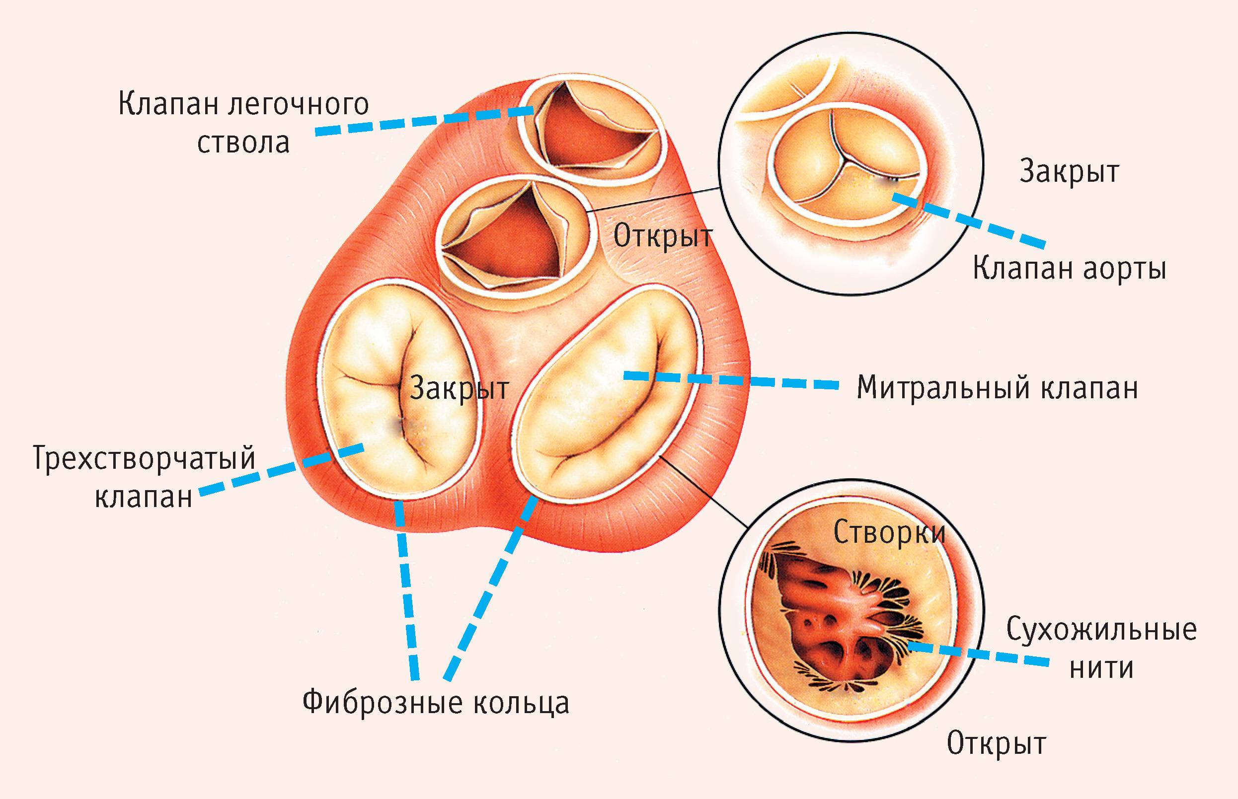 Порок сердца Порок сердца