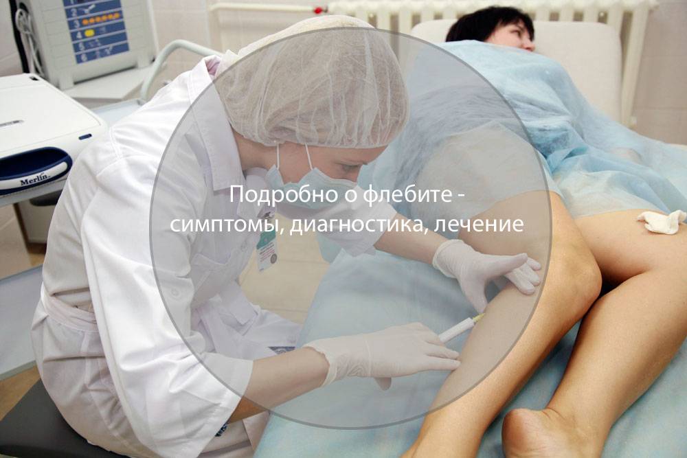 Флебит нижних конечностей