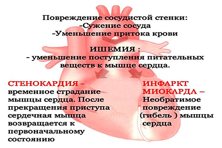 Заболевания сердца