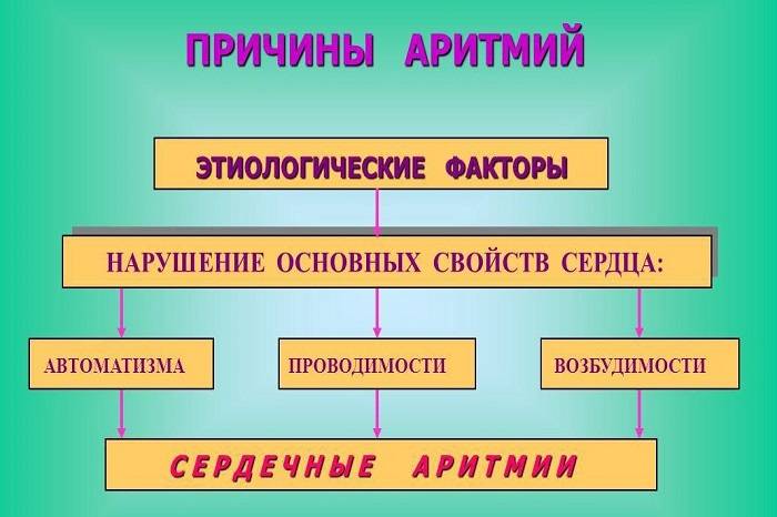 Симптомы и причины аритмий