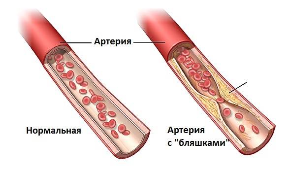 Сосудистые заболевания мозга Сосудистые заболевания мозга