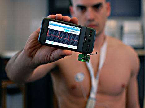 ecg-monitoring