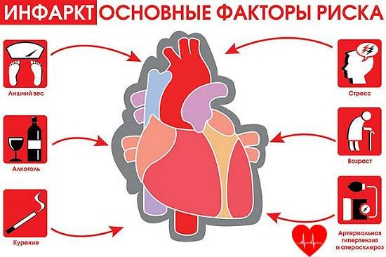 Локализация инфаркта миокарда по экг