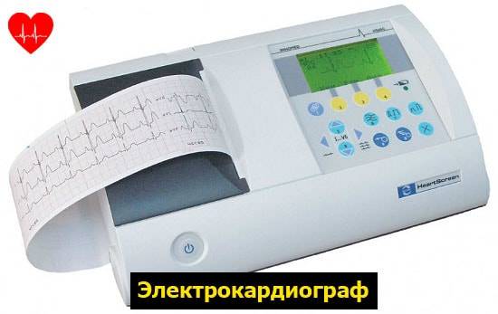 Локализация инфаркта миокарда по экг