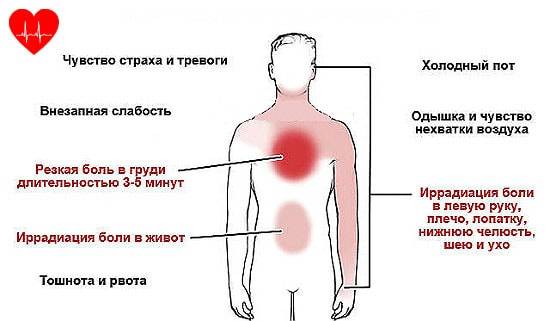 Нестабильная стенокардия симптомы и лечение
