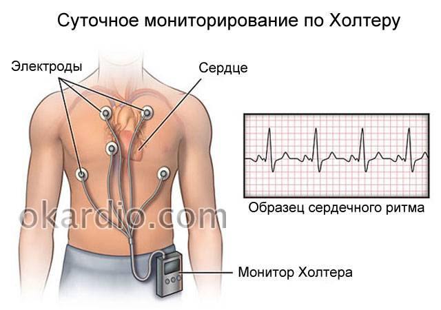 процедура холтеровского мониторирования