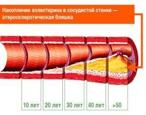 бляшки
