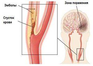 Причины