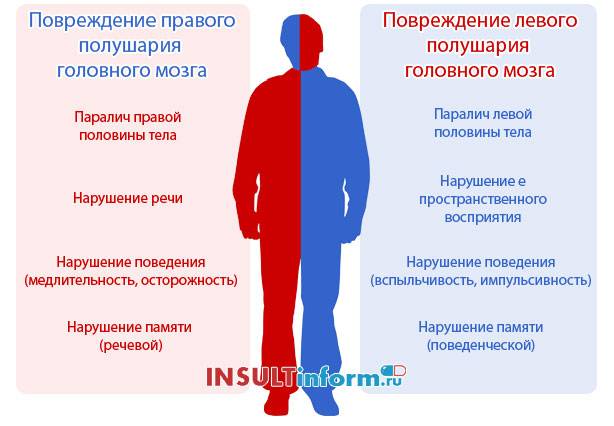 Какой инсульт опаснее левосторонний или правосторонний
