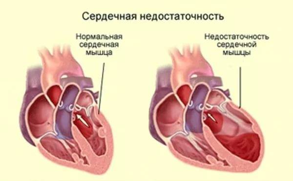 сердце схема