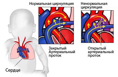 Классификации пороков