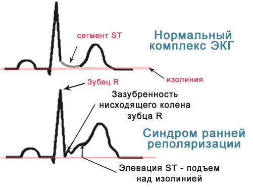 486486846486486
