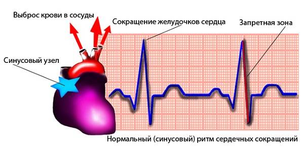 Синусовый ритм сердечных сокращений
