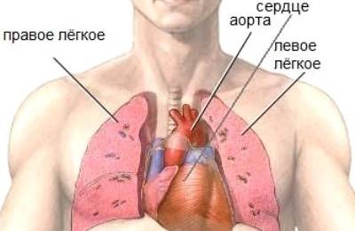 Схема расположения