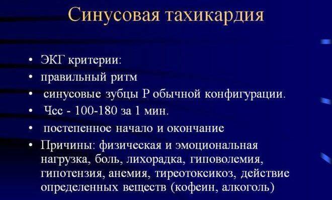 Синусовая тахикардия