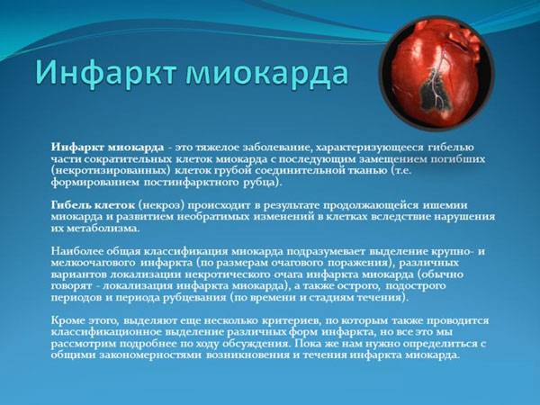 Инфаркт миокарда
