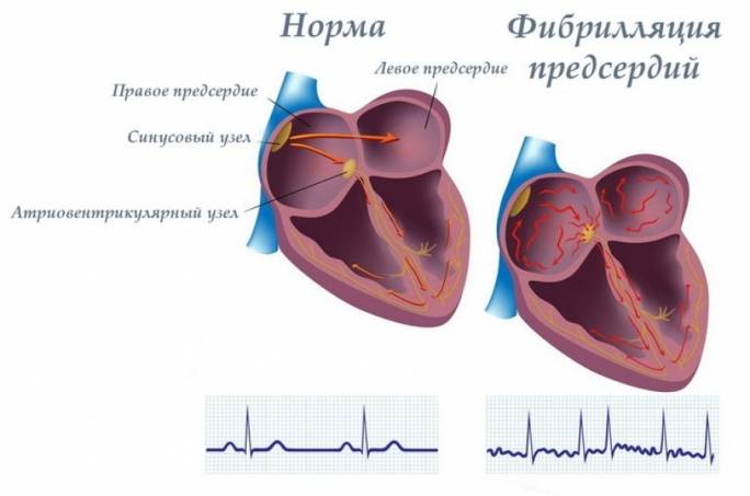 Описание
