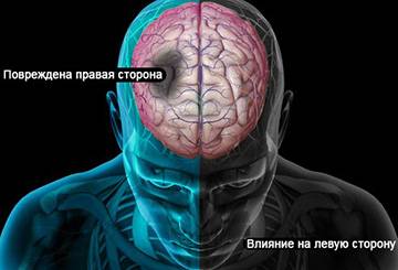 повреждение правой стороны