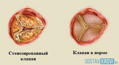 Показания