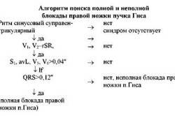 Алгоритм поиска полной и неполной блокады правой ножки пучка Гиса