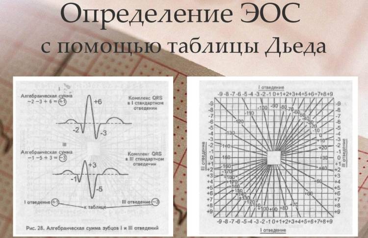 Выявление смещения по таблице Дьеда