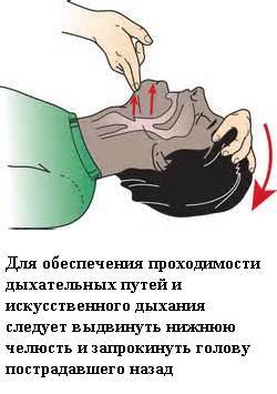 Первая помощь при остановке сердца