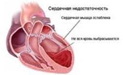 Сердечная патология