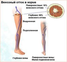 недостаточность вен