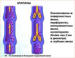 клапанная недостаточность вен