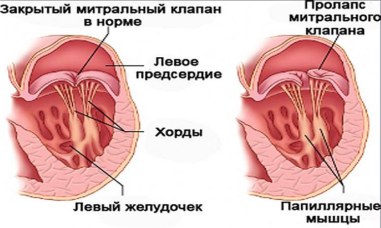 Хорда