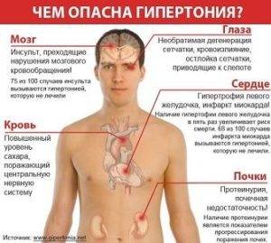Гипертония 1 степени, что это такое?